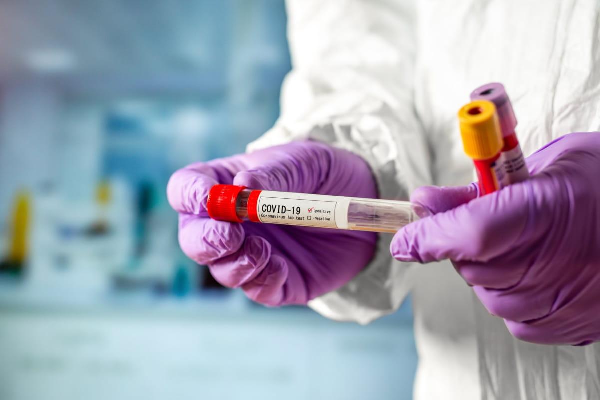 Ukraynada yeni ekspres koronavirus testləri istifadəyə veriləcək 