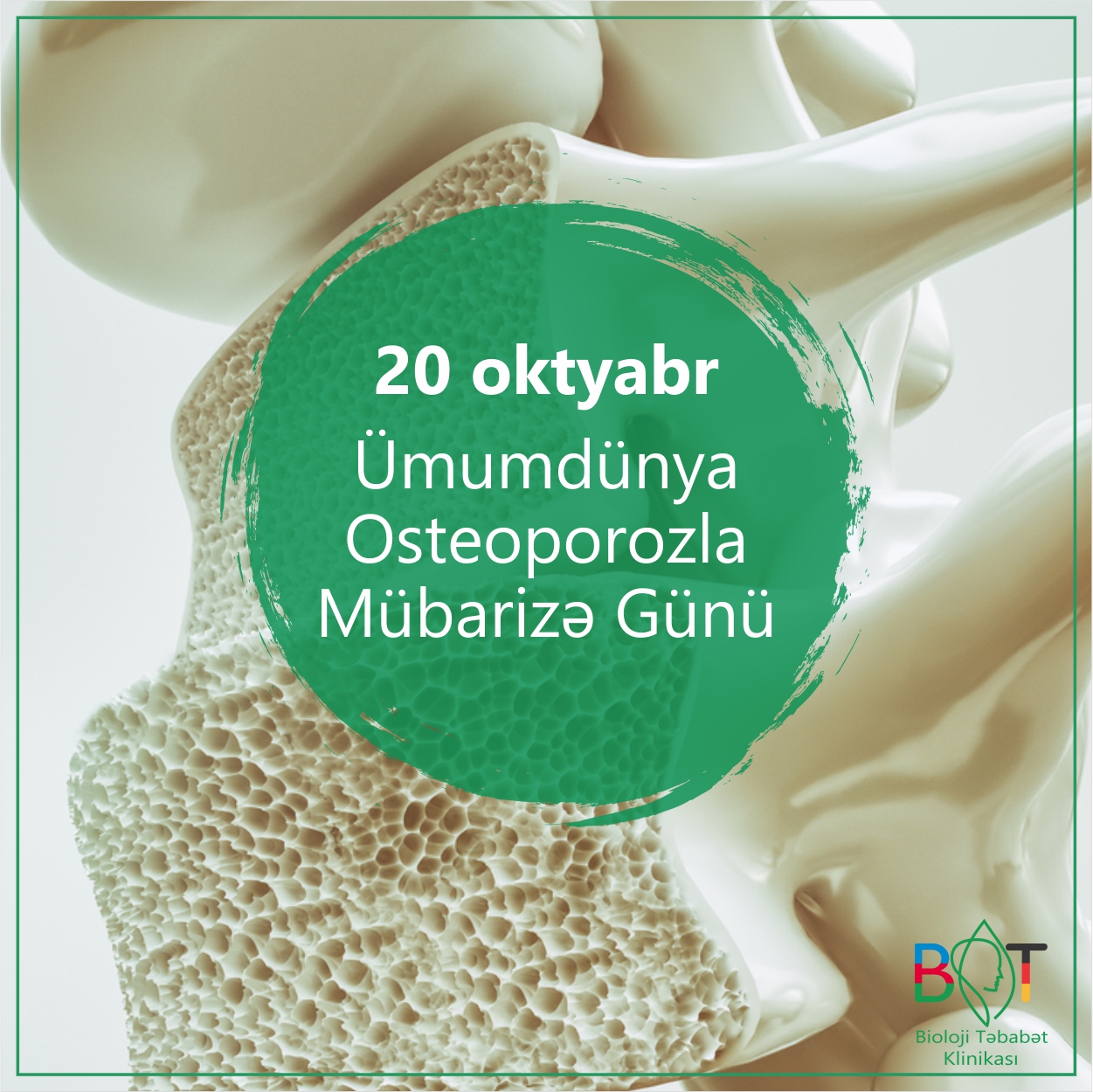 20 oktyabr Osteoporoz günüdür  -  Sümükləriniz əriməsin!