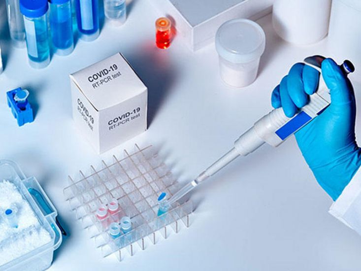 Rusiya MDB ölkələrinə koronavirus testləri tədarük etdi  