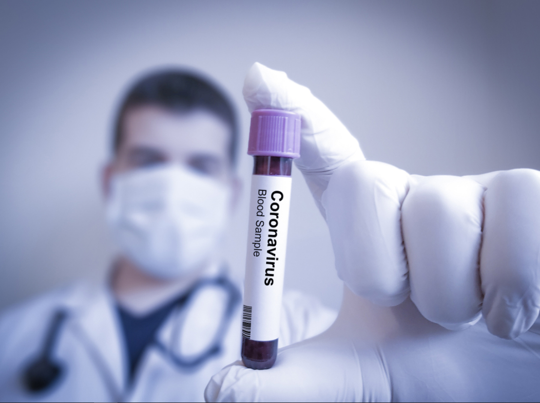 Türkiyədə koronavirusu 10 saniyəyə təyin edən cihaz hazırlandı 