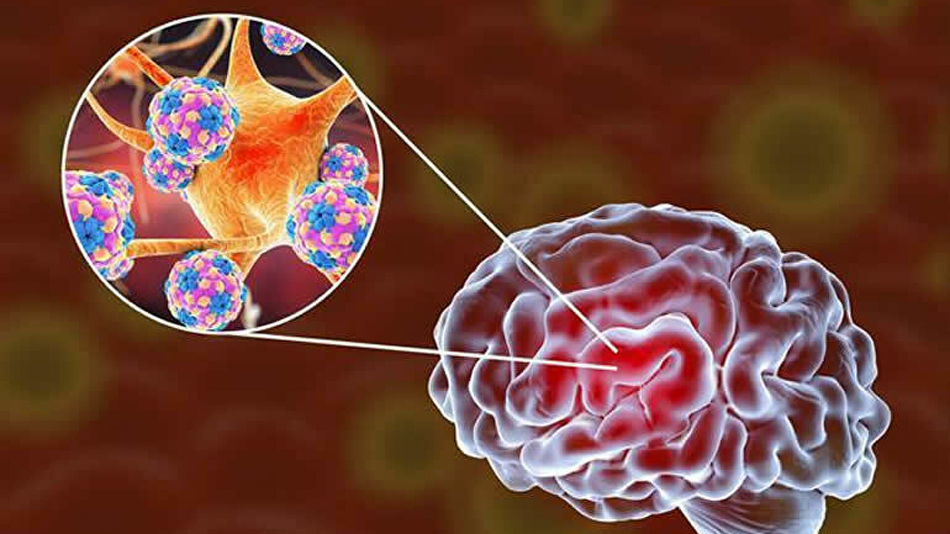 Koronavirus uzun müddət beyin və bağırsaqlarda qalır  – Alimlər