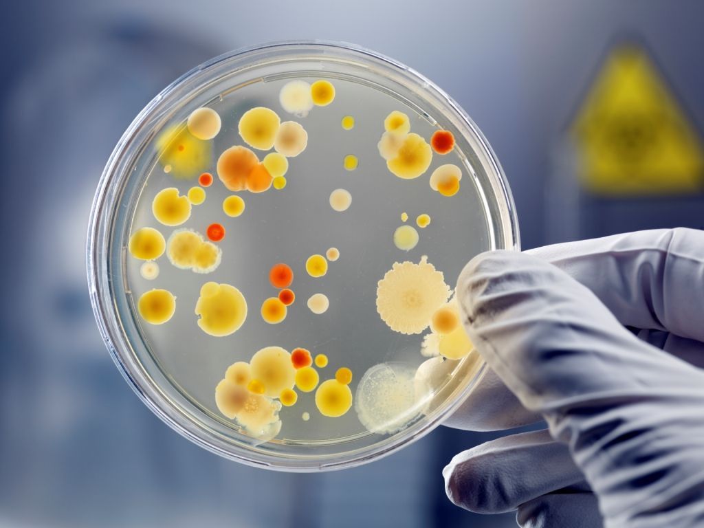 “Mikrobların antibiotiklərə qarşı dözümlülüyünin artması bizim üçün təhlükədir” -  ÜST  narahatdır