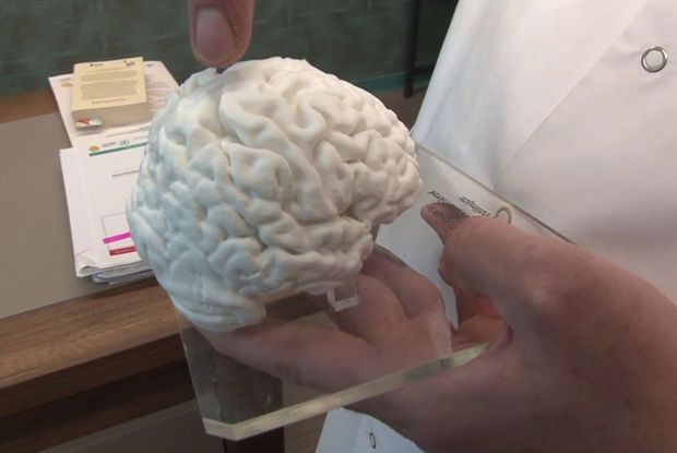 Türkiyədə printerlə insan beyni hazırlandı 