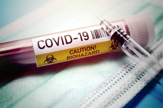Güclü antibiotik və bahalı dərmanlar koronavirusu   -   Daha da azğınlaşdıracaq