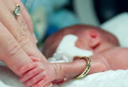 Erkən doğulmuş uşaqlara yüksək səs olmaz  - Nazirliyin ekspert pediatrı