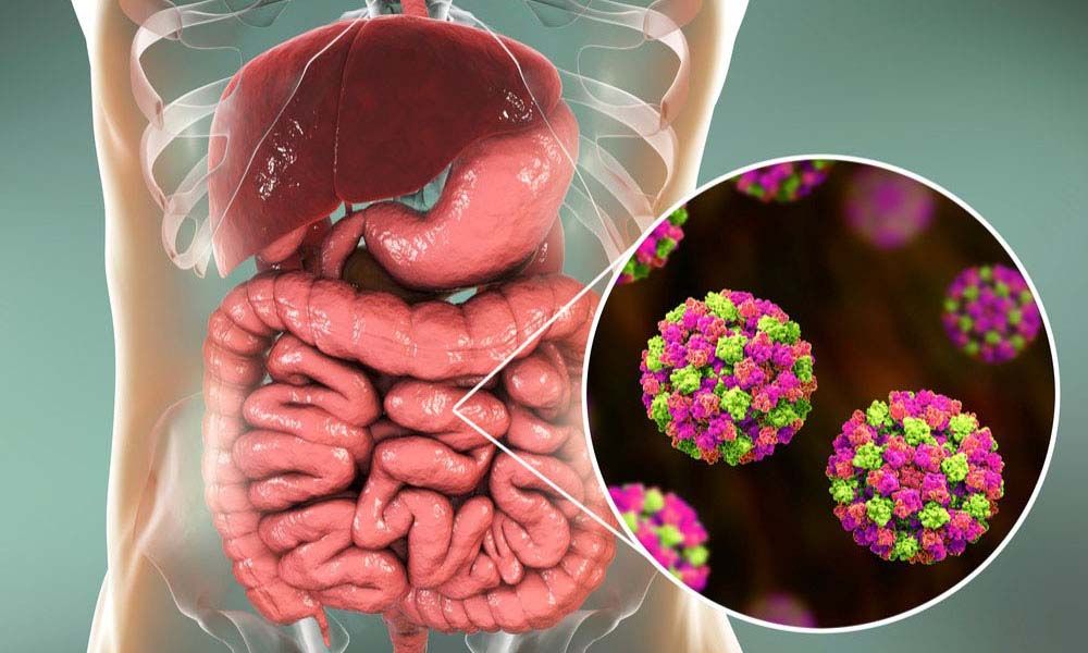 Koronavirus birbaşa mədə-bağırsaq sisteminə təsir edir  - Səhiyyə nazirliyi eksperti