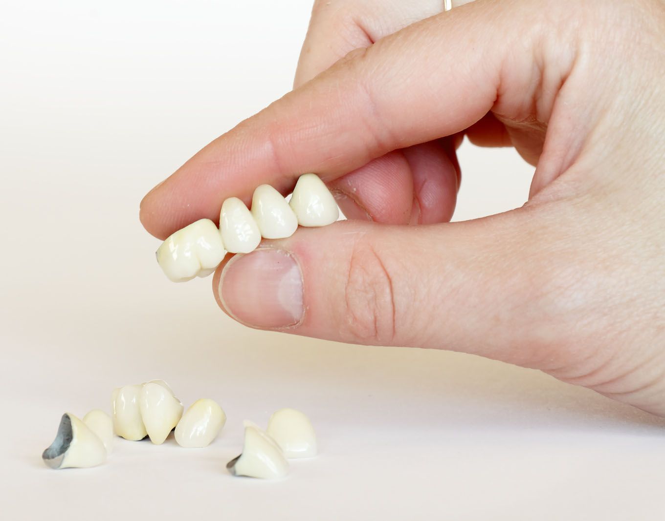 80% insanlar 40 yaşdan sonra dişlərini bu səbəbdən itirir   -  ALİMLƏR