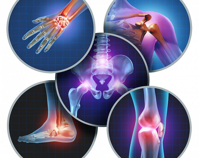 Böyük-kiçik oynaqlarda ağrı və yeyilmə səbəbi   - Osteoartrit nədir?