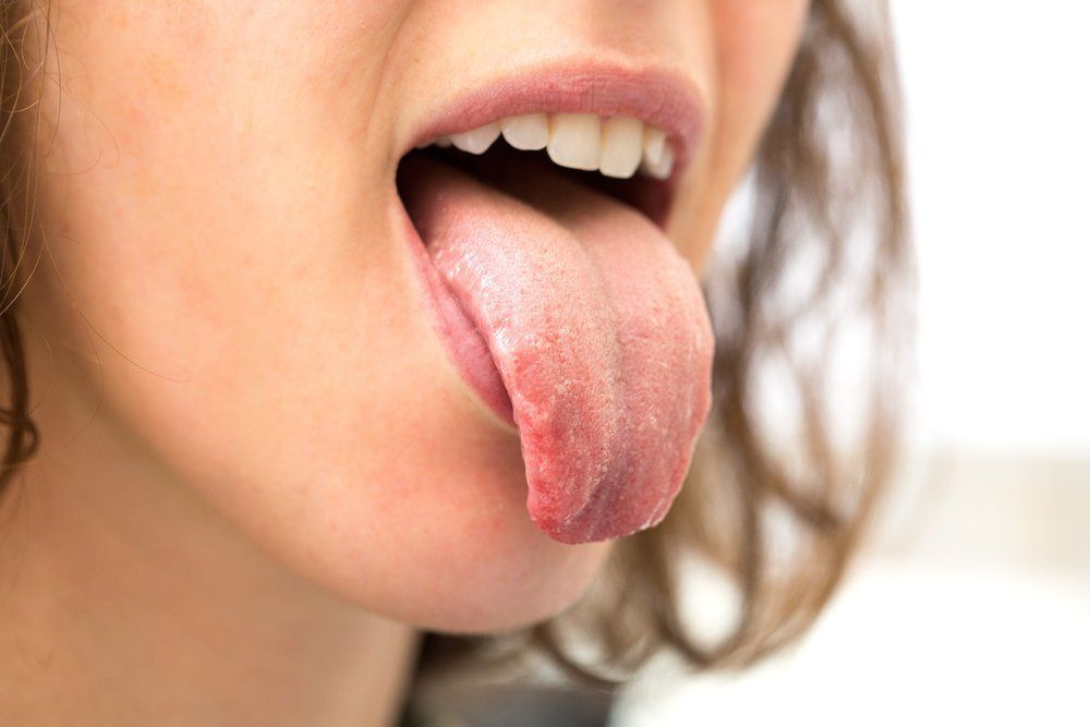 Dilin rəngi hansı xəstəliklərdən xəbər verir? 