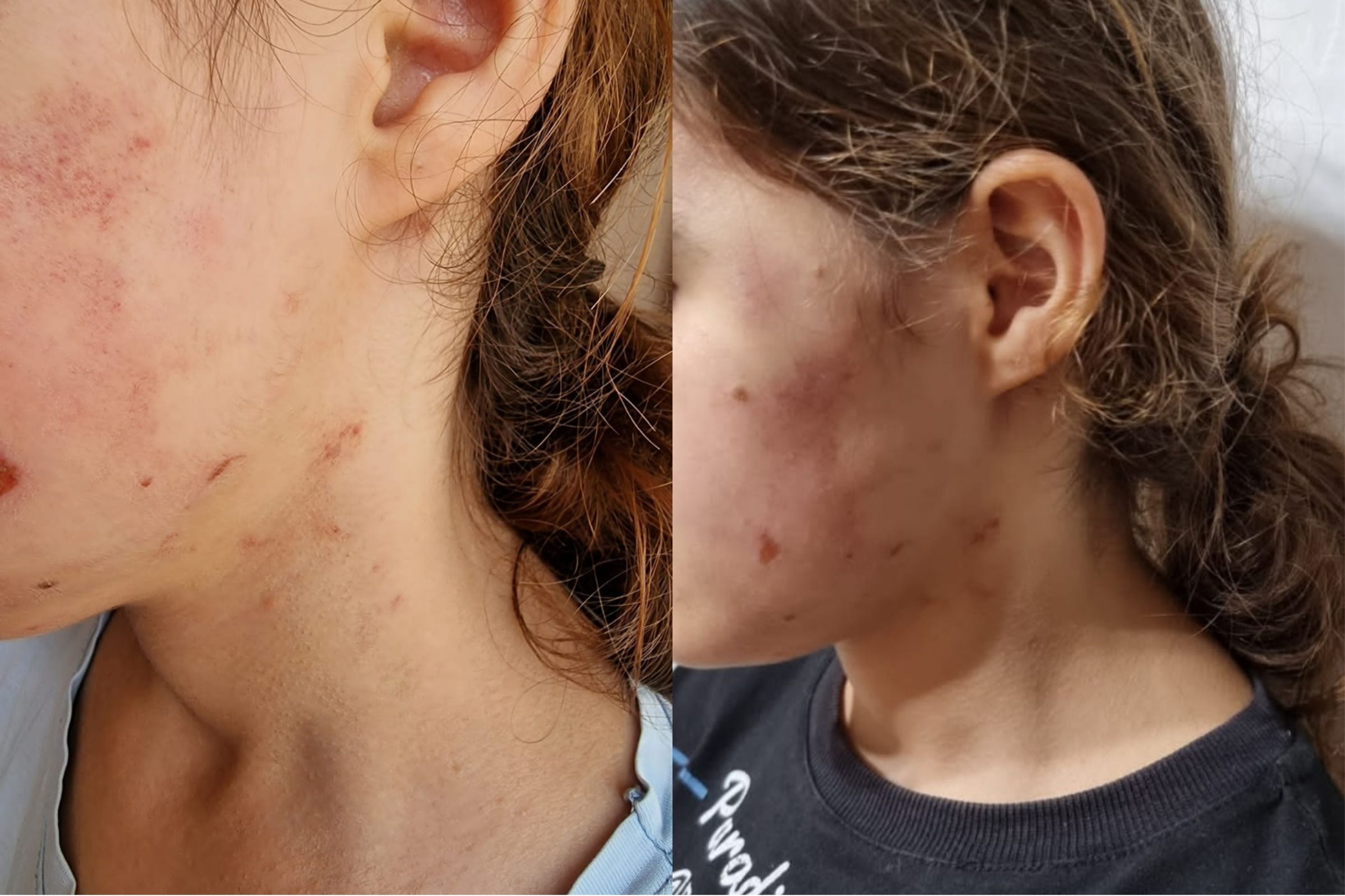 Lənkəranda icra başçısının müavini məktəbli qızı döydü-    "Uşağı evinə aparıb, başına oyun açıb"