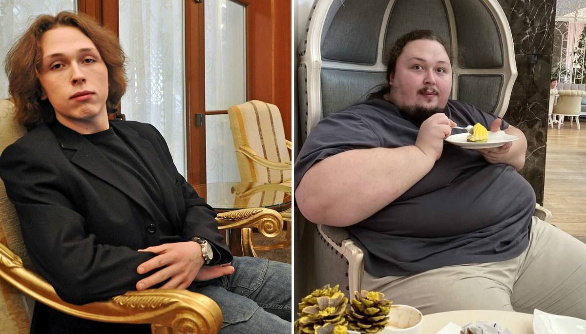 Rusiyalı  rəssamın oğlu sanksiyalar səbəbindən 300 kilo oldu 