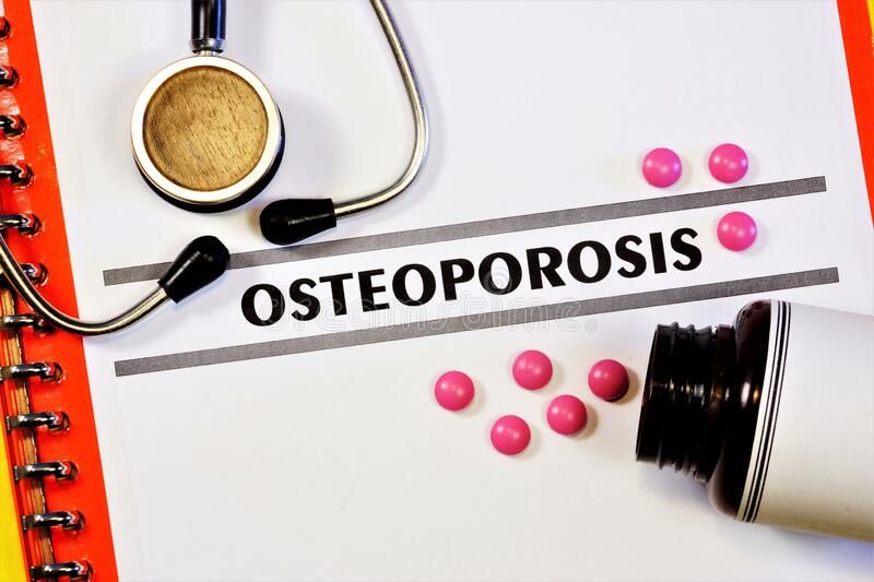 Osteoporoz- sümüklərin əriməsinə qarşı    lazım olan vitaminlər