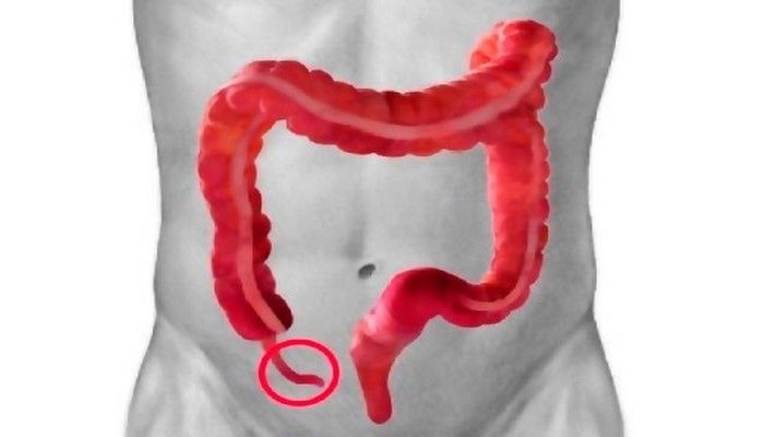 Appendiks immunitet üçün vacib orqandır  - Həkim