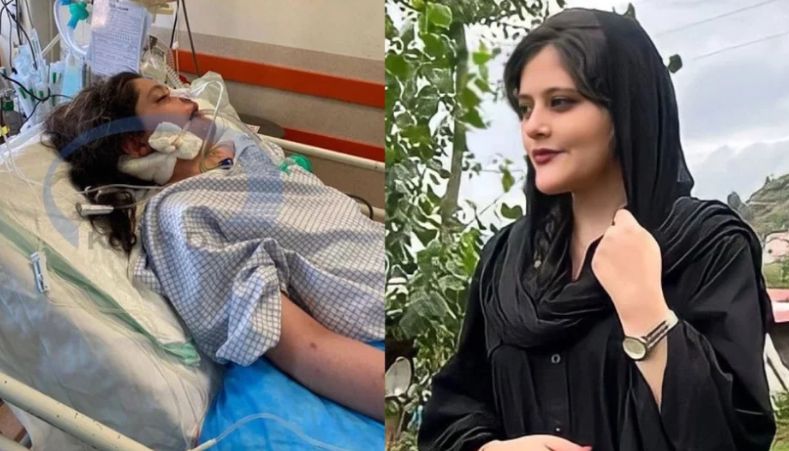 İranda Məhsa Əmininin ölüm səbəbi açıqlandı 