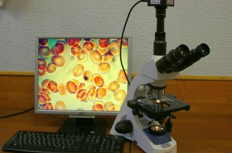 Qanın qaranlıqsahəli mikroskopiyası  analizi  - Nəyi göstərir?