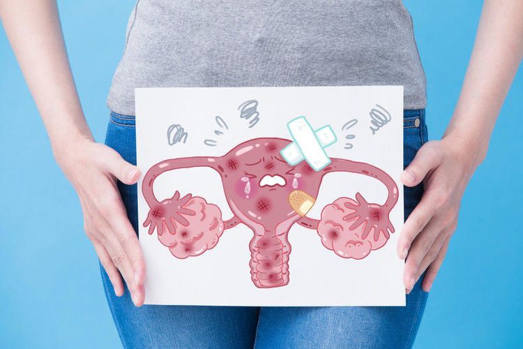 Endometrioz və menstrual ağrıların fərqi 