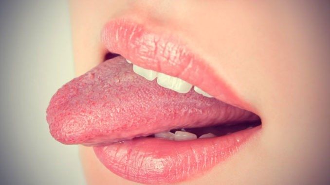 Dildə ağrılı yaraların səbəbi   - xərçəng ola bilər