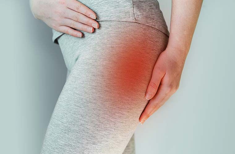 Piriformis sindromu – oturaq sinirin təzyiqi - Necə müalicə olunur? 