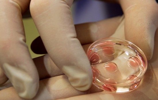 Qadın embrionları kişilərdən daha tez ölür  