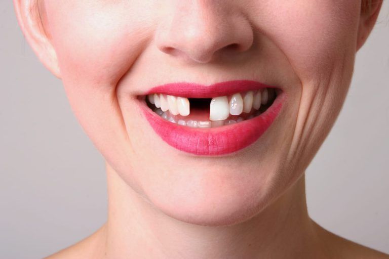 Dişlərin forması insanın xarakterinə   - təsir edir