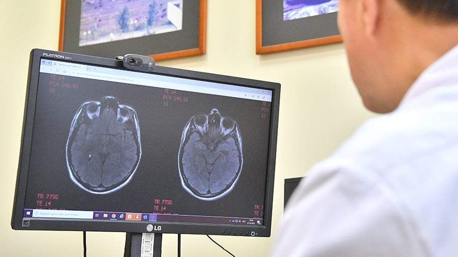 Dünyada ilk   - 19 yaşlı gəncdə demensiya aşkarlandı