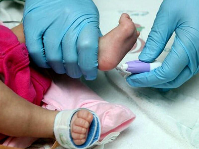 Azərbaycanda 20 min körpəyə    topuq testi olunub