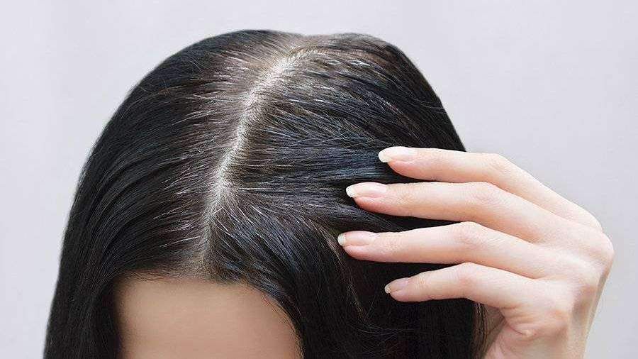 Cavan yaşda saçların ağarmasının   - əsas səbəbi