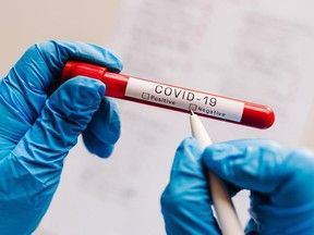 Koronavirusa yoluxanların sayı 10 faiz artıb -  Avropanın statistikası