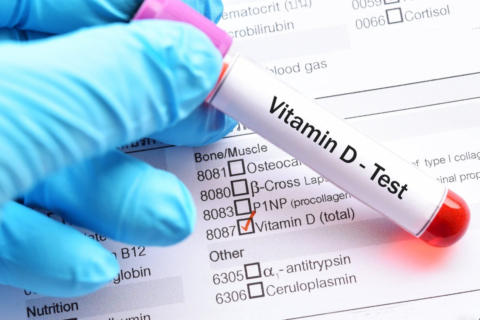 Vitamin D analizini vermək boşuna pul itkisidir  – Həkim