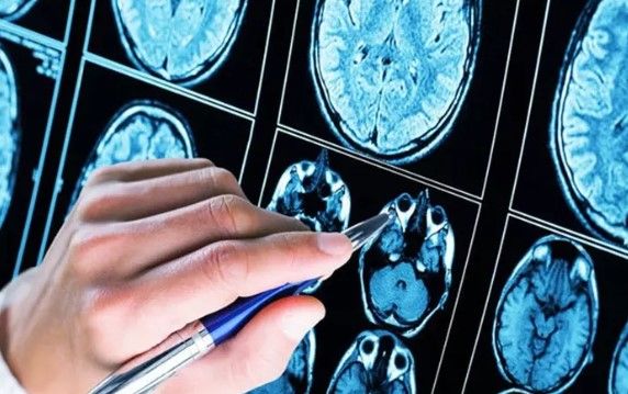 Kimlər erkən demensiya riski altındadır?  