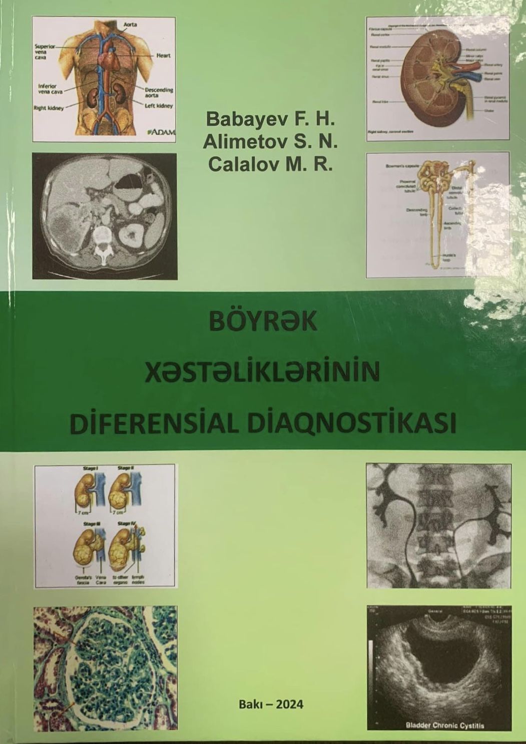 Respublika Kliniki Uroloji Xəstəxanasının    direktorunun kitabı çıxdı