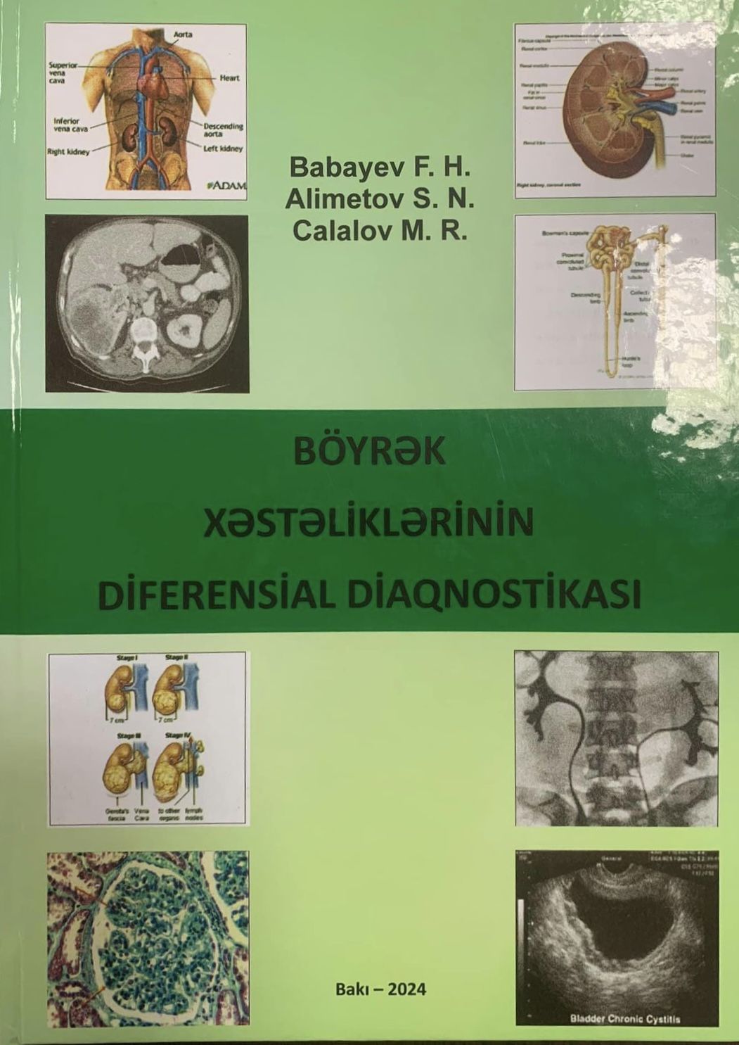 Respublika Kliniki Uroloji Xəstəxanasınındirektorunun kitabı çıxdı