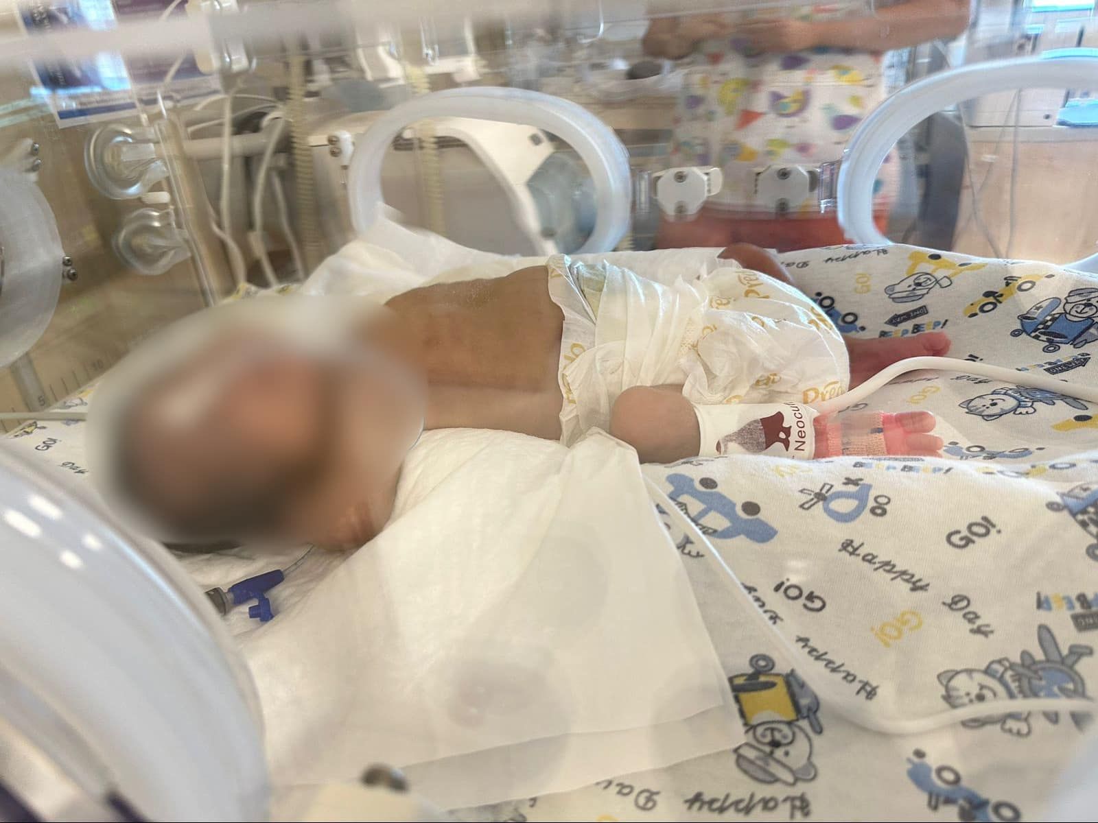 26 həftəlik doğulan körpə 1 aydan sonra   evə buraxıldı