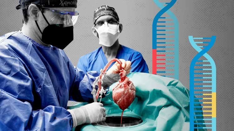 Oğlunu qurtarmaq üçün 18 kq arıqladı 