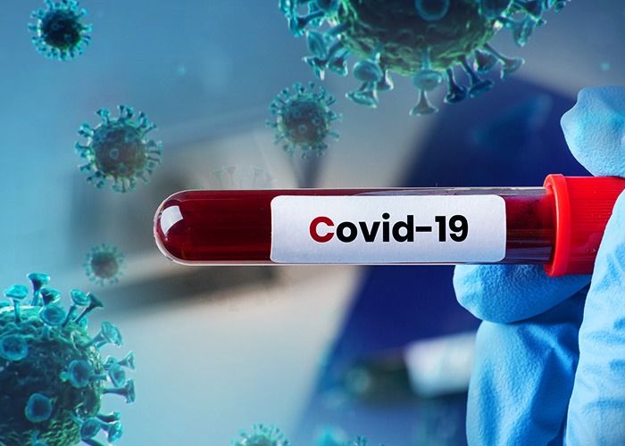 Alimlərdən COVID-19-la bağlı   yeni kəşf