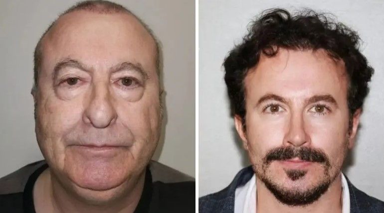 Dünya ondan danışır: Türkiyəyə gəlib 30 yaş cavanlaşan adam -  FOTO