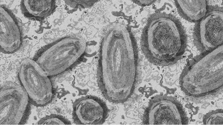 Daha bir epidemiya xəbərdarlığı:  3 nəfər öldü