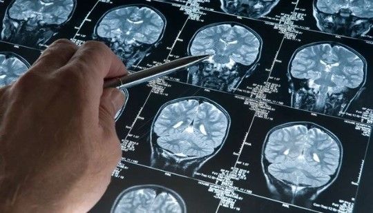 Musiqi dinləməyin Alzheimer xəstələrinə faydaları  AÇIQLANDI