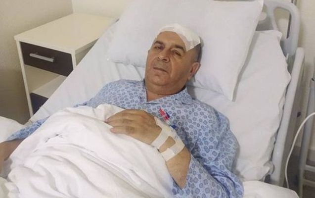 Allahverdi Yolçuyevin  beyninə pil yerləşdirildi
