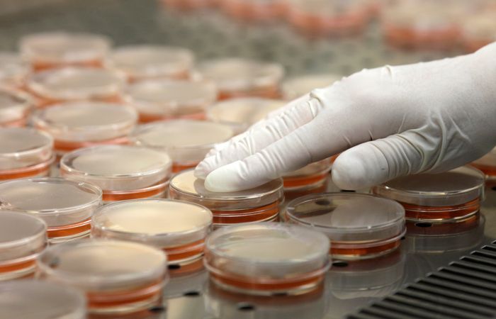 Avstraliyada laboratoriyadan yüzlərlə ölümcül virus     yoxa çıxıb