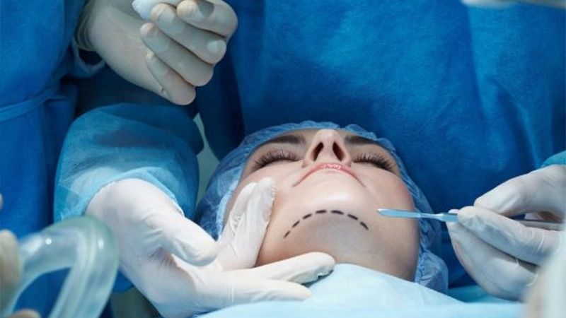 Bu tarixədək plastik cərrahlıqla bağlı sənəd qəbulu dayandırılır 