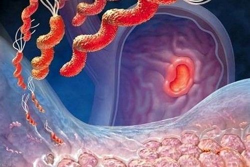 Alimlər mədə xorasının 1 vitaminlə    müalicəsini tapdılar