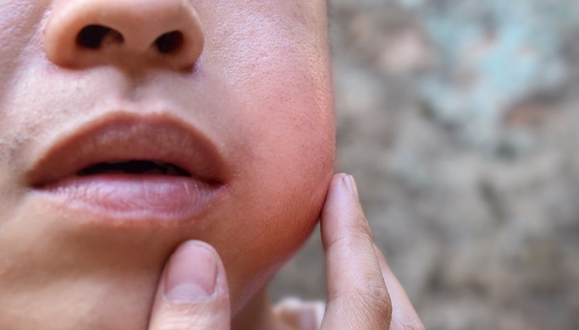 Rusiyada sonsuzluğa səbəb olan     təhlükəli epidemiya