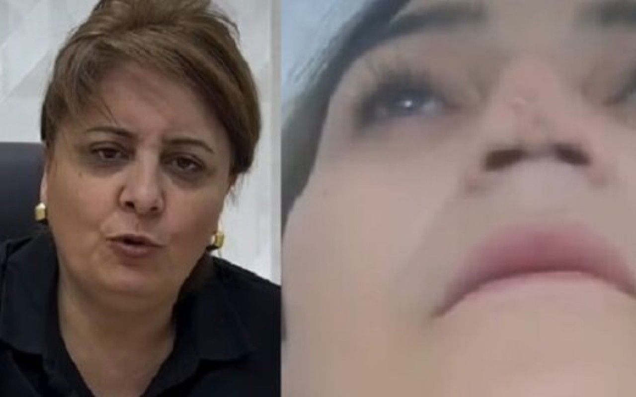 "Medaura" klinikasının baş həkiminin uğursuz əməliyyatı - Qadın tanınmaz hala düşdü -  FOTO