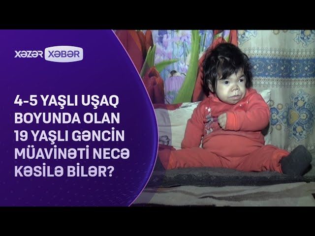 Bu uşağın 19 yaşı var  - Nadir diaqnoz