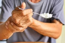 Parkinson xəstəliyinin gözlərdə görünən    əlaməti