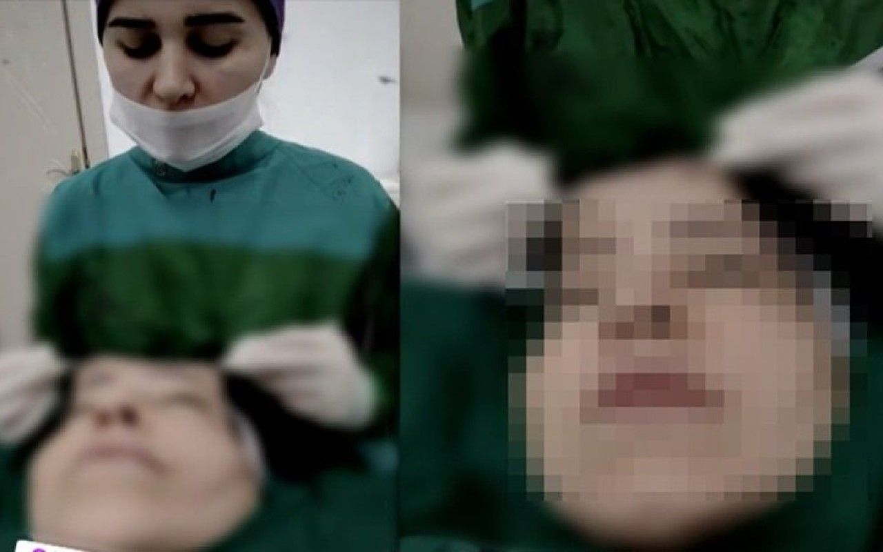Daha bir cərrah əməliyyat zamanı canlı yayım açdı -  Araşdırma başladı