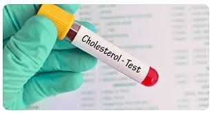 Xolesterin analizi nə vaxt verilməlidir? 