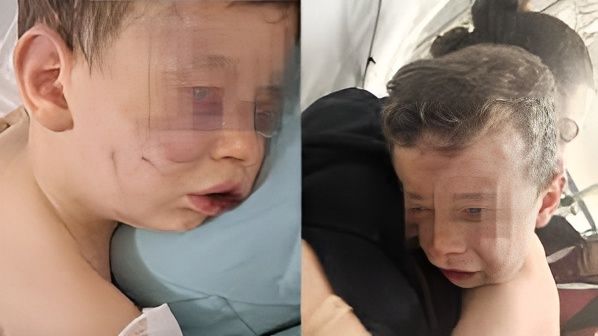 2 yaşlı uşaq vəhşicəsinə döyüldü -  FOTO