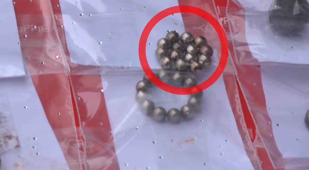 Uşaq bir gündə 43 maqnit uddu 
